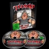 A GIRL CALLED CERVEZA LTD. EDIT. (CD+DVD DIGI)