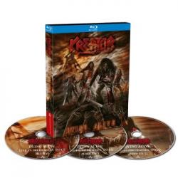 DYING ALIVE LTD. EDIT. (BLURAY+2CD DIGI)